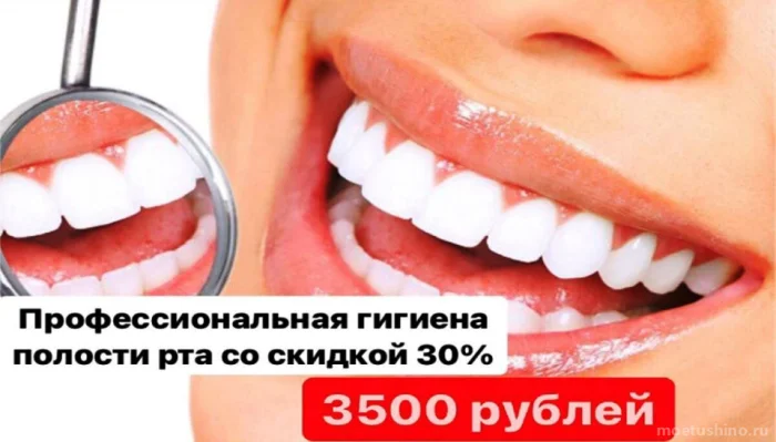 Профессиональная гигиена полости рта со скидкой 30% 3500 руб